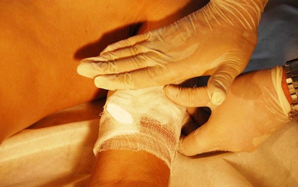 Первая помощь при острой кровопотере и травматическом шоке		 
			Первая помощь при острой кровопотере и травматическом шоке