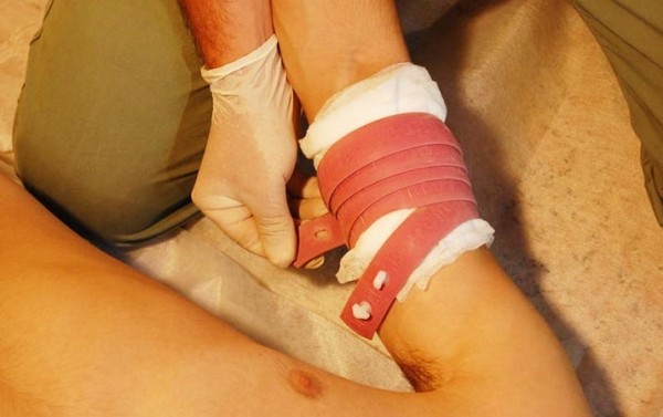 Первая помощь при острой кровопотере и травматическом шоке		 
			Первая помощь при острой кровопотере и травматическом шоке