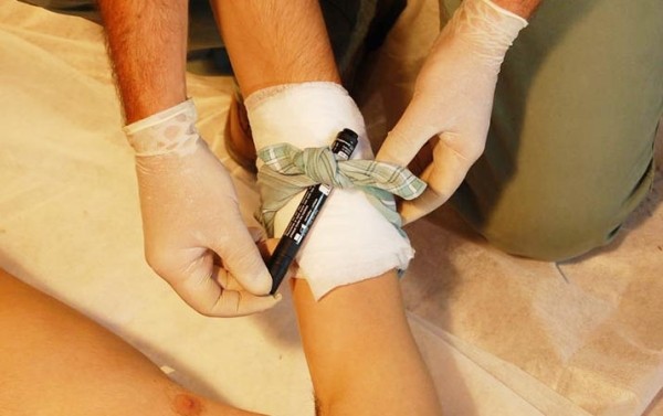 Первая помощь при острой кровопотере и травматическом шоке		 
			Первая помощь при острой кровопотере и травматическом шоке