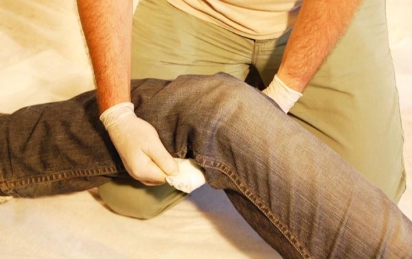 Первая помощь при острой кровопотере и травматическом шоке		 
			Первая помощь при острой кровопотере и травматическом шоке