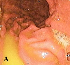 
			Халитоз: от симптома к диагнозу и терапии		