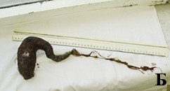 
			Халитоз: от симптома к диагнозу и терапии		