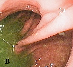 
			Халитоз: от симптома к диагнозу и терапии		