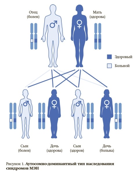 
			Онкоэндокринология: синдром множественной эндокринной неоплазии 2А типа		