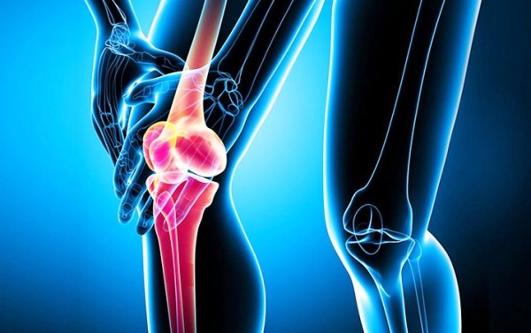 Остановить остеоартрит: в помощь — гиалуроновая кислота
Остановить остеоартрит: в помощь — гиалуроновая кислота