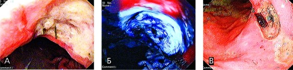 Острая гастродуоденальная боль. Часть 2
Острая гастродуоденальная боль. Часть 2