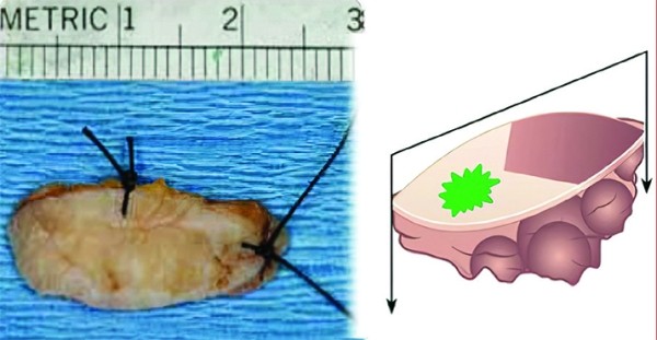 
			Патогистологическое сопровождение при диагностике заболеваний		