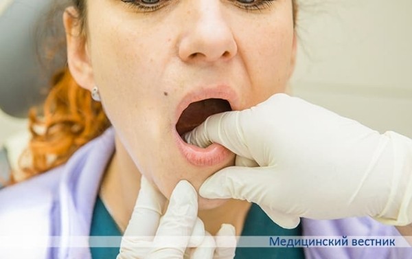 
        Опухоли полости рта и глотки: стратегия ранней диагностики			    