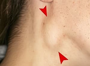 
        Возвращение туляремии…Что следующее?			    