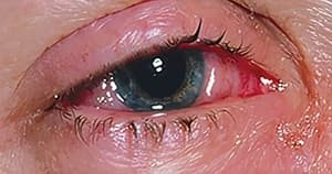 
        Возвращение туляремии…Что следующее?			    