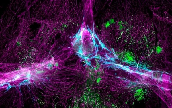 
        Ученые обнаружили, что мозг не особая закрытая зона			    