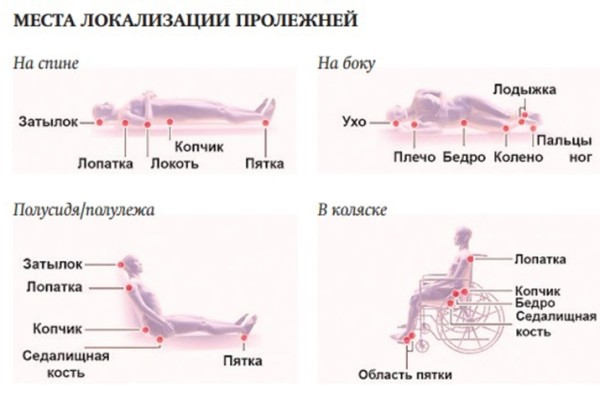 
        Принципы терапии и ухода за пациентами с поражениями кожи                     