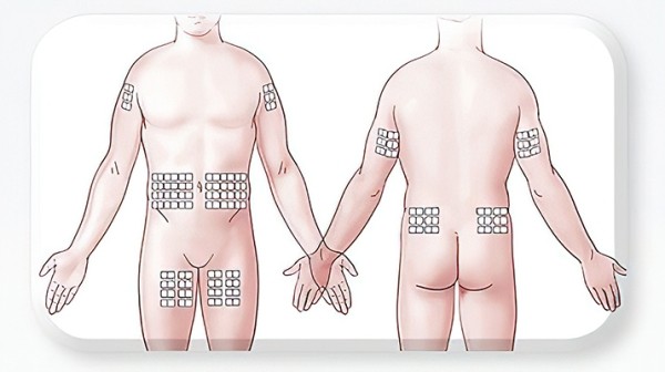 
        Заместительная терапия препаратами иммуноглобулина для подкожного введения у пациентов детского возраста с ПИД                     