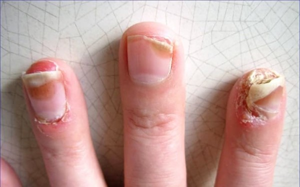 
        Ногти: клинико-диагностическая значимость в практике дерматолога + аудио                
        
        