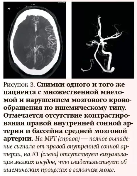 
        Лучевая диагностика при кровотечениях и тромбозах: плюсы и минусы разных методов                    