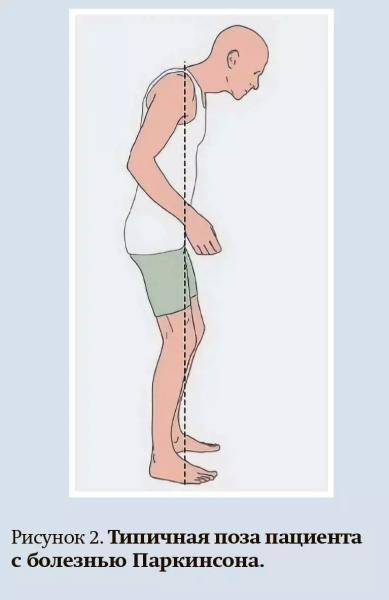 
        Ранние стадии болезни Паркинсона: диагностика и лечение + аудио                
        
        