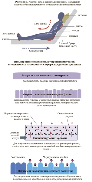 
			Профилактика и лечение пролежней		