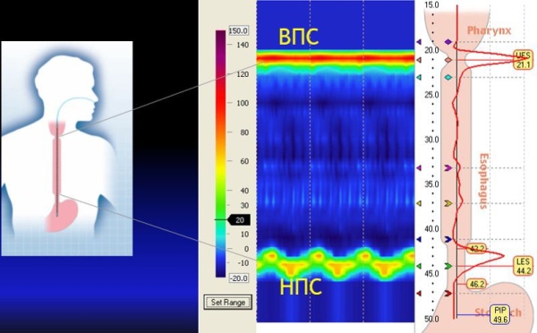 
			Манометрия пищевода высокого разрешения		