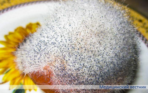 Плесневые грибы и опасность инвазивных микозов
Плесневые грибы и опасность инвазивных микозов