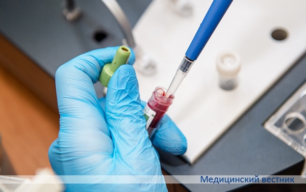 Почему не получается коагулограмма		 
			Почему не получается коагулограмма