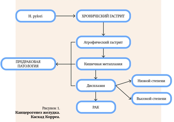 
			Природа хронической гастродуоденальной боли. Часть 1		